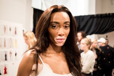 Winnie Harlow được NTK Nguyễn Công Trí mời trình diễn BST mới nhất